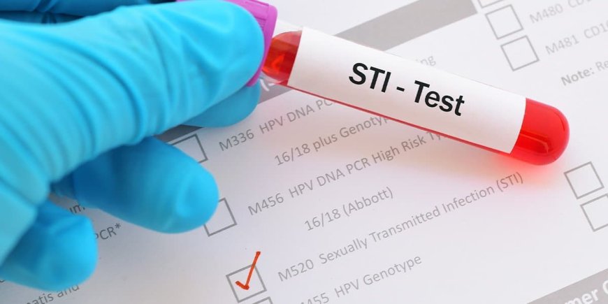 How to Get Tested for STIs: A Step-by-Step Guide