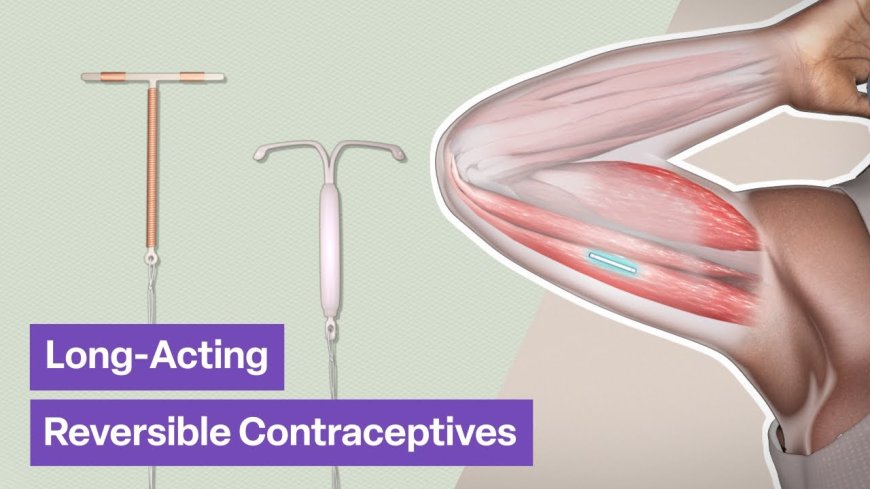 How Long-Acting Reversible Contraceptives (LARCs) Work
